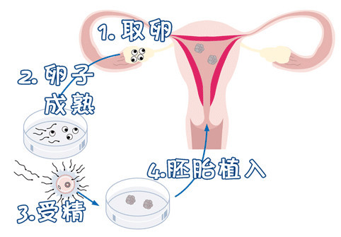 捐卵联系方式